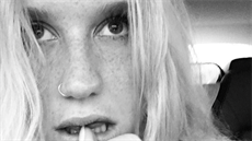 Kesha má ohro�enou kariéru!
