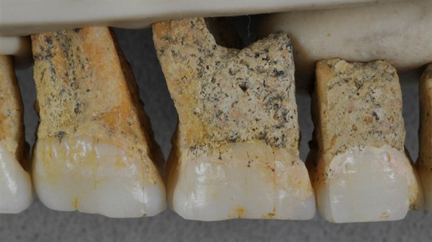 Horn zuby zejm nov objevenho druhu lovka, Homo luzonensis. (11.4.2019)