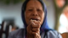 V Nepálu žijí tisíce malomocných. | na serveru Lidovky.cz | aktuální zprávy