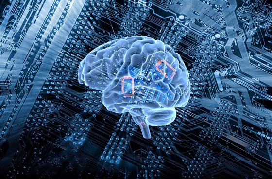 Muskova společnost Neuralink má za cíl propojit lidský mozek s počítačem.
