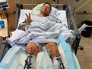 Libor Podmol se zotavuje po těžkém pádu v mnichovské nemocnici.
