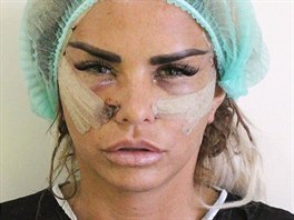 Katie Price den po zákroku, kdy si nechala upravit obliej na klinice v Turecku.