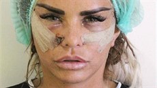 Katie Price den po zákroku, kdy si nechala upravit obliej na klinice v Turecku.