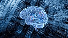 Muskova společnost Neuralink má za cíl propojit lidský mozek s počítačem.