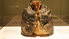 Plíce kuřáka - model z výstavy.