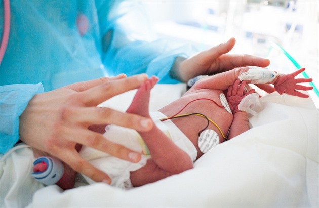 Novorozenci s kardiomyopatií selhávalo srdce, lékaři v Motole orgán transplantovali