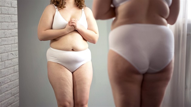 Obézní lidé v kleštích. Zdraví jim podlamuje tuk, na duši útočí fatfobie