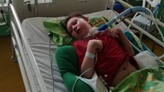 Adámek čtyři dny po operaci mandlí začal silně krvácet, minuty čekal na pomoc... | na serveru Lidovky.cz | aktuální zprávy