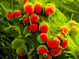 Detailní pohled na bakterii zvanou Neisseria gonorrhoeae, která zpsobuje...