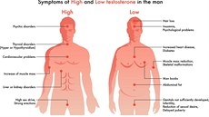 Vysoká hladina testosteronu s sebou nese silné libido, ale i nemoci jater a...