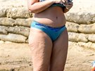 Britská televizní celebrita Josie Gibsonová se také potýká s pomeranovou...