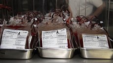 Krevní transfuze | na serveru Lidovky.cz | aktuální zprávy