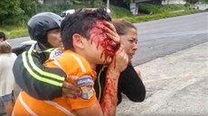 estnáctiletý Rufo Chacon zranný pi stetu demonstrant s policií ve...