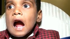Indický sedmiletý chlapec ml v ústech 526 zub a nádor