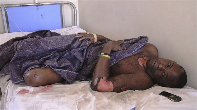 Poplen pacient le v nemocnici pot, co utrpl zrann pi vbuchu cisterny s palivem v Tanzanii. (10. srpna 2019)