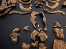 Archeologov� na�li v Kopidln� kostru keltsk� �eny. M�la zka�en� zuby.