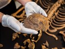 Archeologov� na�li v Kopidln� kostru keltsk� �eny. M�la zka�en� zuby a...
