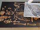 Archeologov� na�li v Kopidln� kostru keltsk� �eny. M�la zka�en� zuby.