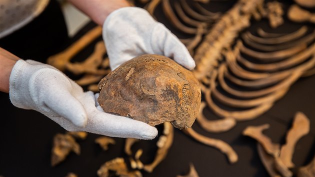 Archeologové našli v Kopidlně kostru keltské ženy. Měla zkažené zuby a deformovanou část lebky.