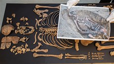 Archeologové nali v Kopidln kostru keltské eny. Mla zkaené zuby.