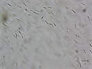 Snmek pozen z mikroskopu, zhruba tisckrt zvten. Sirn bakterie...