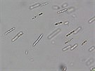 Snmek pozen z mikroskopu, zhruba tisckrt zvten. Sirn bakterie...