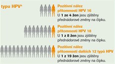 Infografika: pednádorové zmny na dloním ípku.