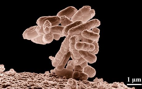 Tyinková bakterie E. coli pi tisícinásobném zvtení