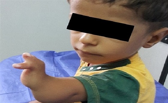 Snímek postieného iráckého chlapce ze studie o zdravotních rizicích v okolí...