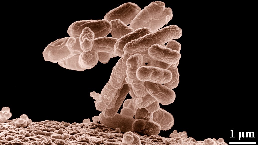 Tyčinková bakterie E. coli při tisícinásobném zvětšení