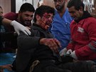 Lékai oetují zranného bojovníka jednotky YPG v den, kdy americký prezident...
