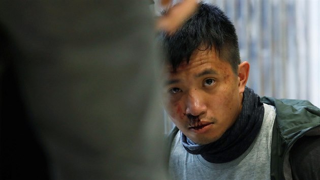 Zaten zrann demonstrant, kter protestoval v nkupnm stedisku v Hongkongu (28. prosince 2019)