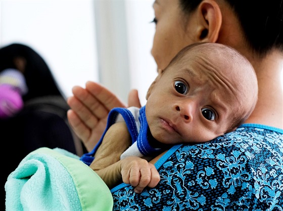 Francys Riverová se svým dvouměsíčním synem trpícím podvýživou.  