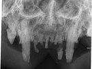 Intraorální RTG snímek horní čelisti kočky postižené resorpční lézí zubů