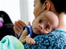 Francys Riverová se svým dvouměsíčním synem trpícím podvýživou. 