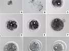 Proces vvoje nov vytvoenho embrya: a) oocyt odebran Fatu . 5 - ped...