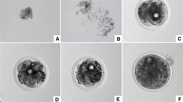 Proces vvoje nov vytvoenho embrya: a) oocyt odebran Fatu . 5 - ped zrnm; b) oocyt odebran Fatu . 5  - po zrn; c) oocyt injikovan spermatem Suniho, rozdlen do dvou bunk; d) embryo Fatu x Suni ve fzi 8 bunk; e) kompaktn morula; f) blastocysta; g) blastocysta ped zmrazenm; h) zmrazovac fze 1; i) zmrazovac fze 2