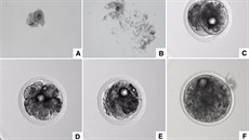 Proces vývoje nov vytvoeného embrya: a) oocyt odebraný Fatu . 5 - ped...