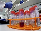 Vědci z berlínského vriologického institutu zkoumají koronavirus, který se...