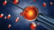 Asistovaná reprodukce (IVF). Ilustraní snímek