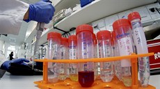Vědci z berlínského vriologického institutu zkoumají koronavirus, který se...
