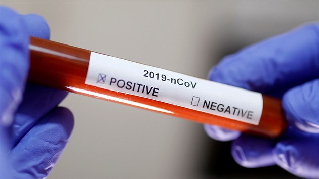 Ampule se vzorky testovanými kvůli potvrzení na koronavir.