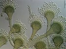 Aspergillus fumigatus zpsobuje onemocnní plic, zvlát u rizikových pacient.