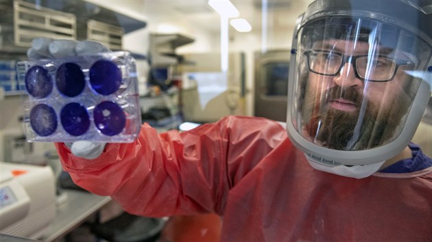 Matt Dunn z výzkumného centra univerzity v americkém Pittsburghu ukazuje mrtvé vzorky nového typu koronaviru. (27. února 2020)