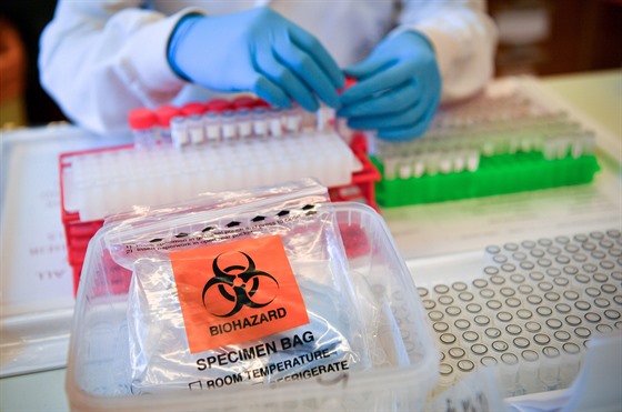 Laboratorní technici provádí diagnostický test na koronavirus. (10. bezna 2020)