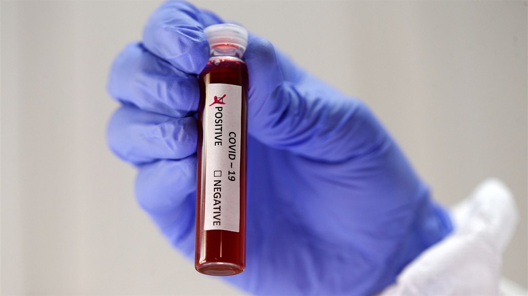 Na olomouckých kolejích už má koronavirus na třicet zahraničních studentů