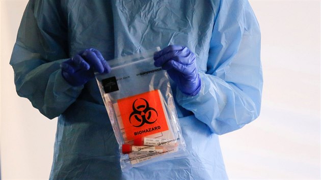 Zdravotní sestra drží testy na onemocnění COVID-19 v Seattlu ve Washingtonu. (9. března 2020)