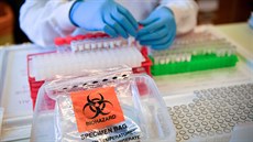 Laboratorní technici provádí diagnostický test na koronavirus. (10. b�ezna 2020)