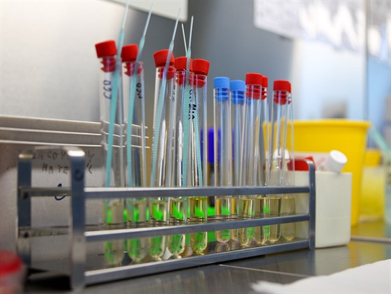 V Ústavu mikrobiologie olomoucké Fakultní nemocnice se kadý den testují vzorky...
