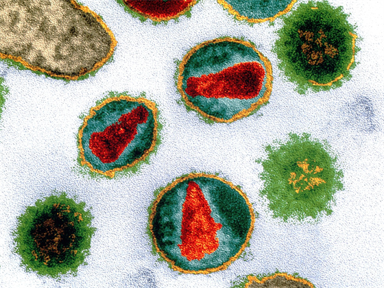 HIV